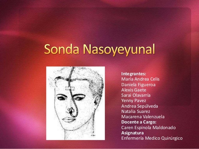 indicaciones de sonda nasoyeyunal